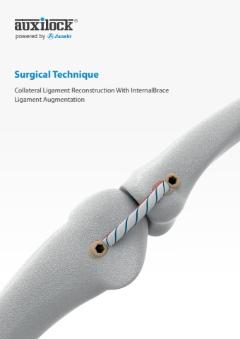 骨盤骨折　Surgical technique